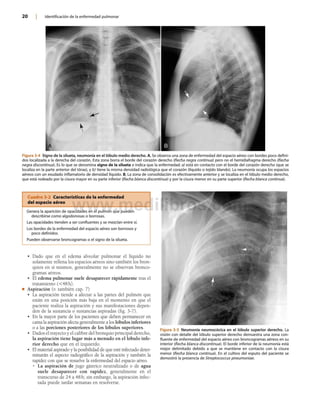 Lobulo Infectado 2 HERRING, Radiologia Basica aspectos fundamentales.pdf