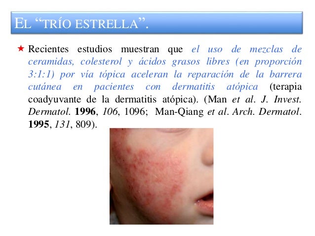 Atopichesky la dermatitis sobre la cabeza del niño