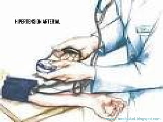 HIPERTENSION ARTERIAL www.1medsalud.blogspot.com 