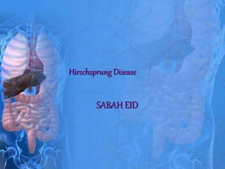 Hirschsprung Disease
SABAH EID
 