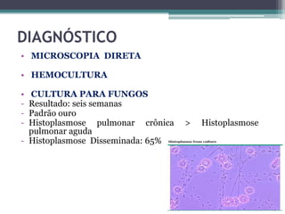 DIAGNÓSTICO
• MICROSCOPIA DIRETA
• HEMOCULTURA
•
-

CULTURA PARA FUNGOS
Resultado: seis semanas
Padrão ouro
Histoplasmose pulmonar crônica
pulmonar aguda
- Histoplasmose Disseminada: 65%

>

Histoplasmose

 