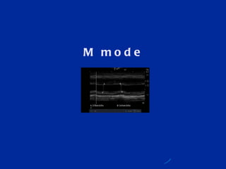 M mode 
