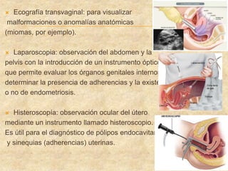  Ecografía transvaginal: para visualizar
malformaciones o anomalías anatómicas
(miomas, por ejemplo).
 Laparoscopia: observación del abdomen y la
pelvis con la introducción de un instrumento óptico,
que permite evaluar los órganos genitales internos y
determinar la presencia de adherencias y la existencia
o no de endometriosis.
 Histeroscopía: observación ocular del útero
mediante un instrumento llamado histeroscopio.
Es útil para el diagnóstico de pólipos endocavitarios
y sinequias (adherencias) uterinas.
 