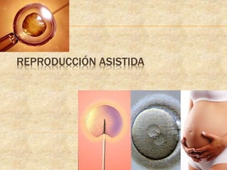 REPRODUCCIÓN ASISTIDA
 