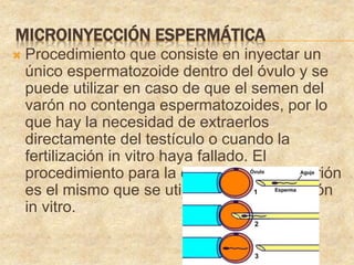 MICROINYECCIÓN ESPERMÁTICA
 Procedimiento que consiste en inyectar un
único espermatozoide dentro del óvulo y se
puede utilizar en caso de que el semen del
varón no contenga espermatozoides, por lo
que hay la necesidad de extraerlos
directamente del testículo o cuando la
fertilización in vitro haya fallado. El
procedimiento para la colocación del embrión
es el mismo que se utiliza en la fecundación
in vitro.
 