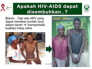 2 informasi dasar hiv aids & ims | PPT