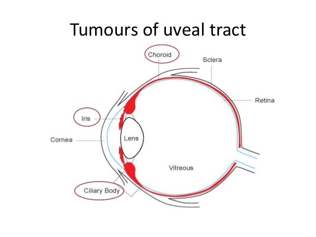 uveal tract