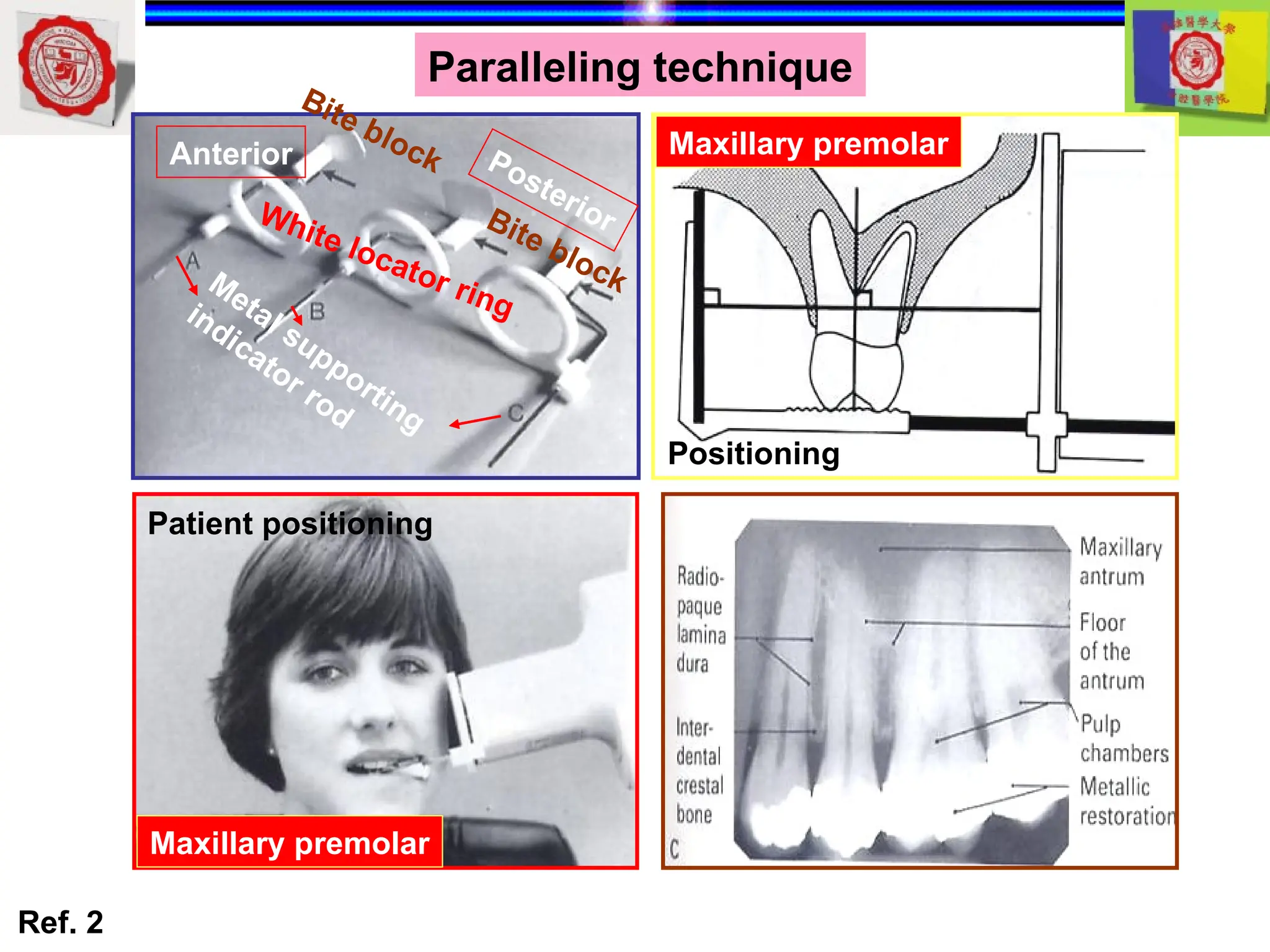 intraoral radiography of jaw in dentistry.ppt
