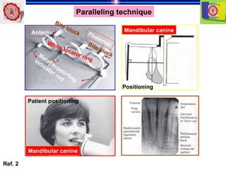 Supporting Block Radiology intraoral radiography of jaw in dentistry.ppt