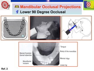 intraoral radiography of jaw in dentistry.ppt