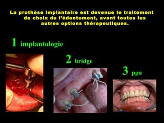 ( 2) introduction a la ppa | PPT