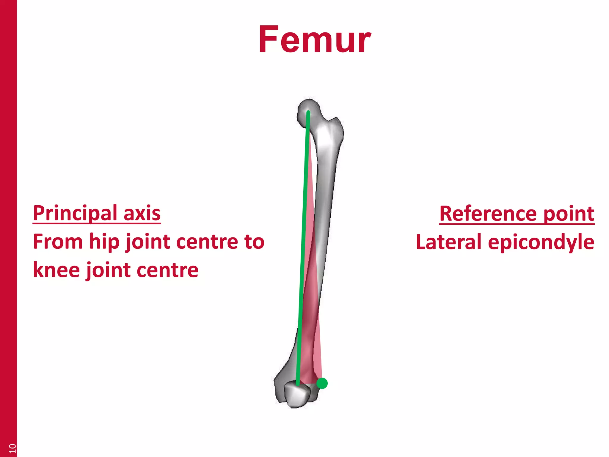 Femur 
10 
Principal axis 
From hip joint centre to 
knee joint centre 
Reference point 
Lateral epicondyle 
 