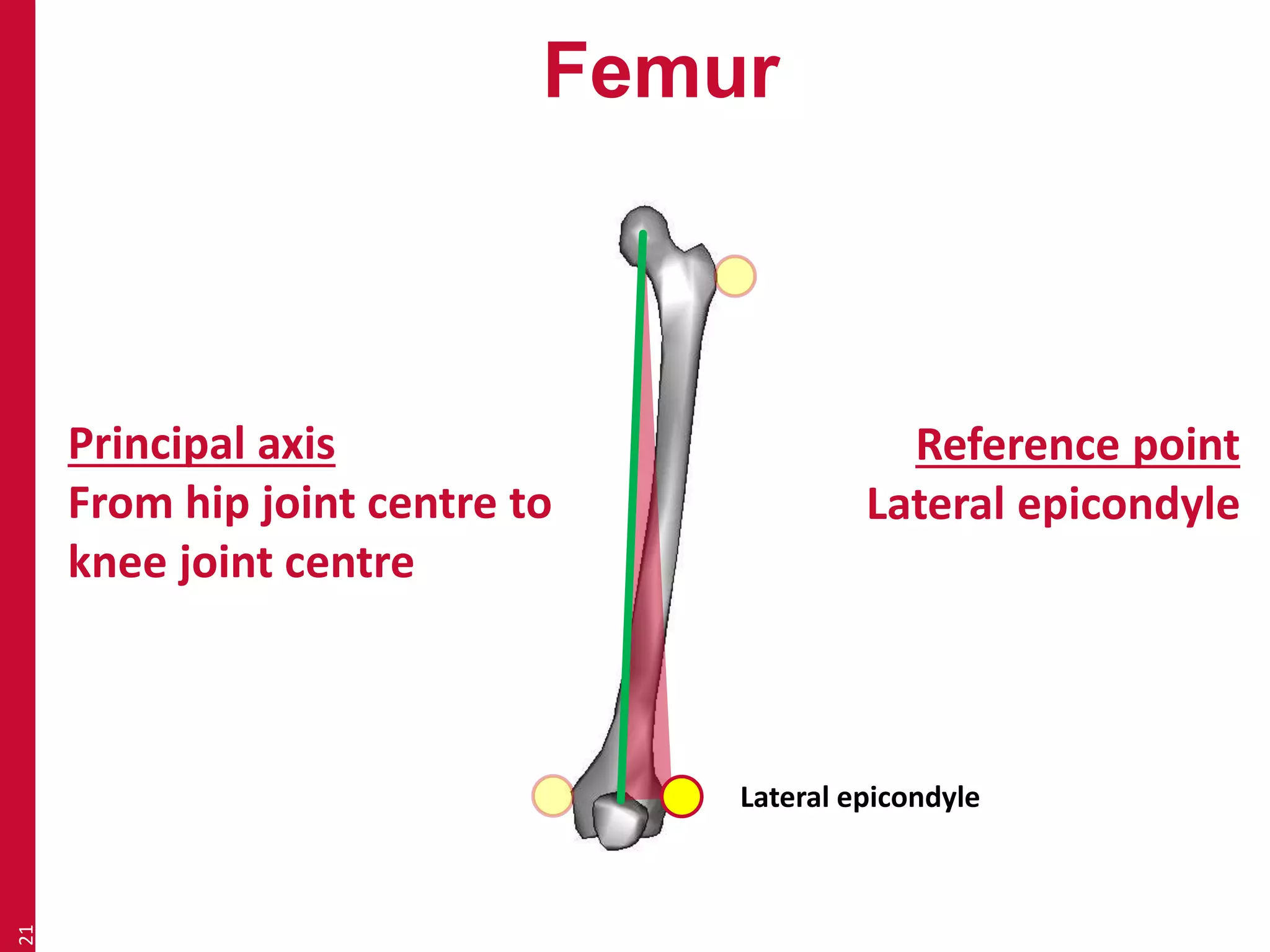 Femur 
21 
Principal axis 
From hip joint centre to 
knee joint centre 
Reference point 
Lateral epicondyle 
Lateral epicondyle 
 