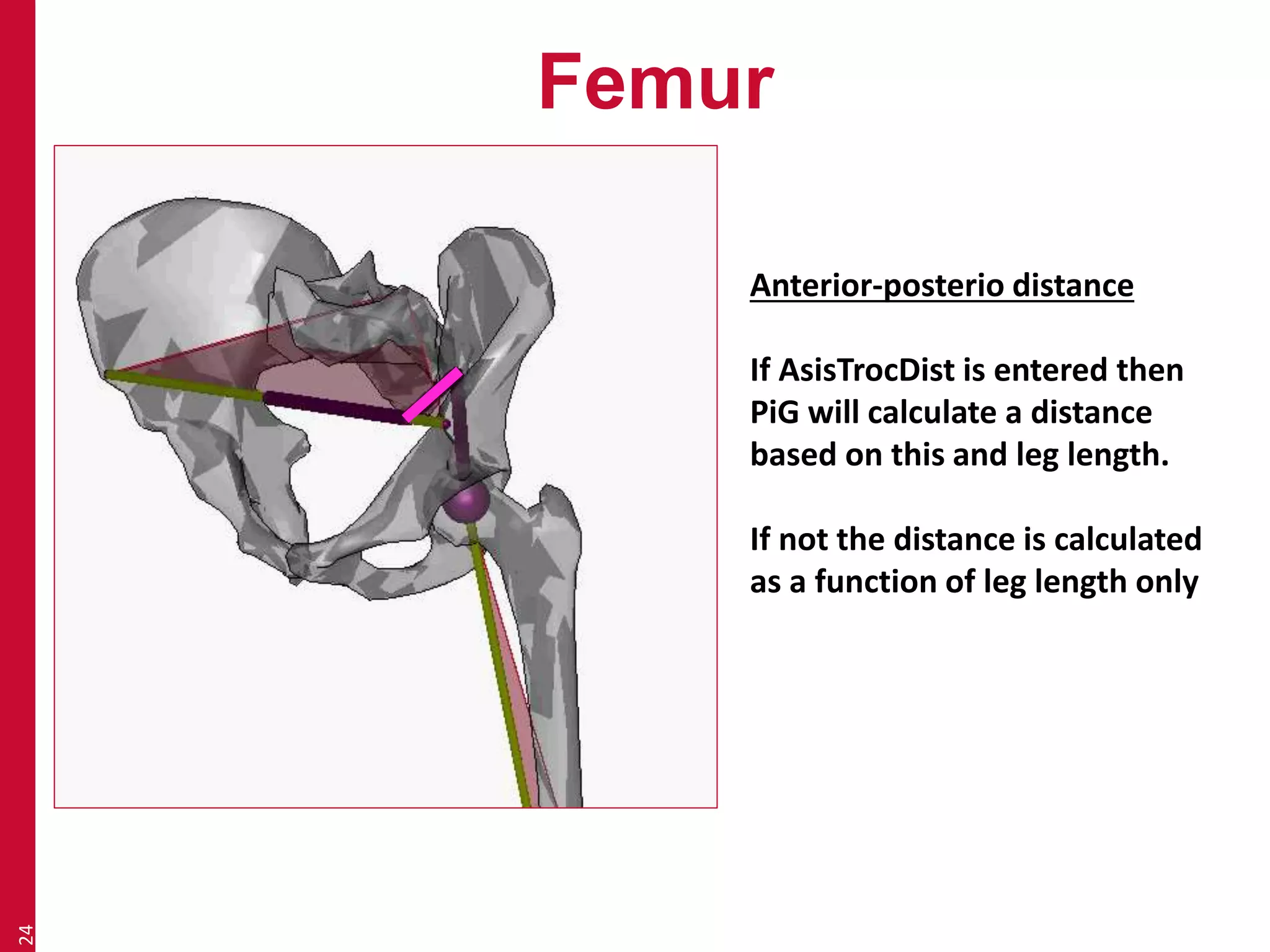 Femur 
24 
Anterior-posterio distance 
If AsisTrocDist is entered then 
PiG will calculate a distance 
based on this and leg length. 
If not the distance is calculated 
as a function of leg length only 
 