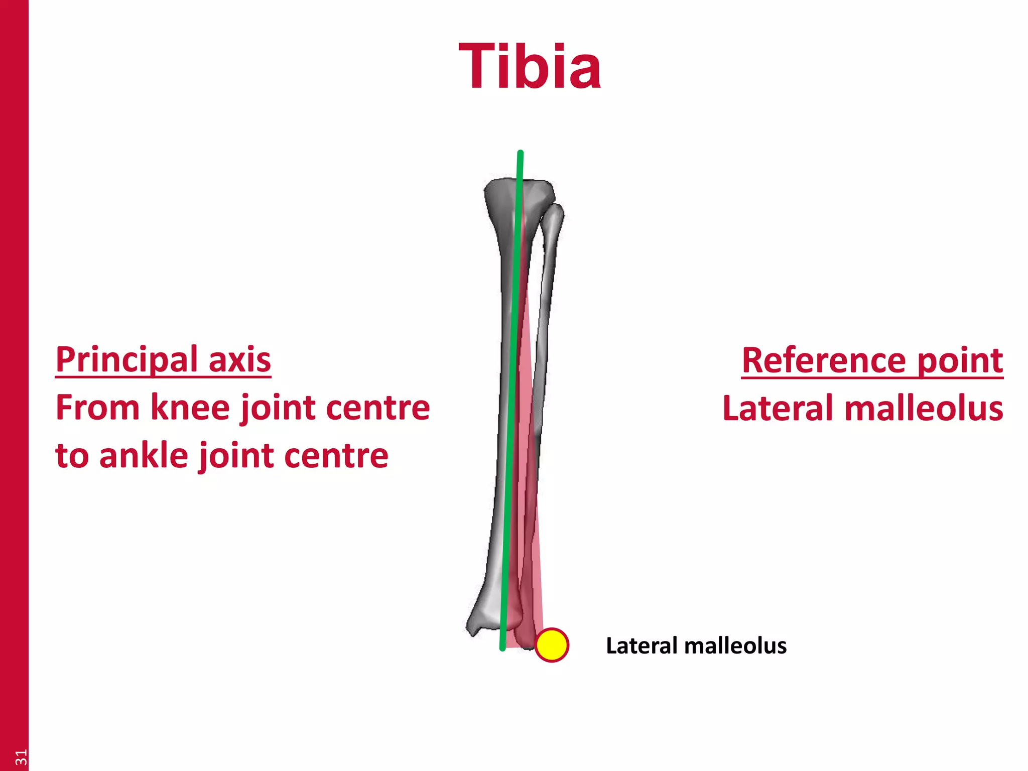 Tibia 
31 
Principal axis 
From knee joint centre 
to ankle joint centre 
Reference point 
Lateral malleolus 
Lateral malleolus 
 