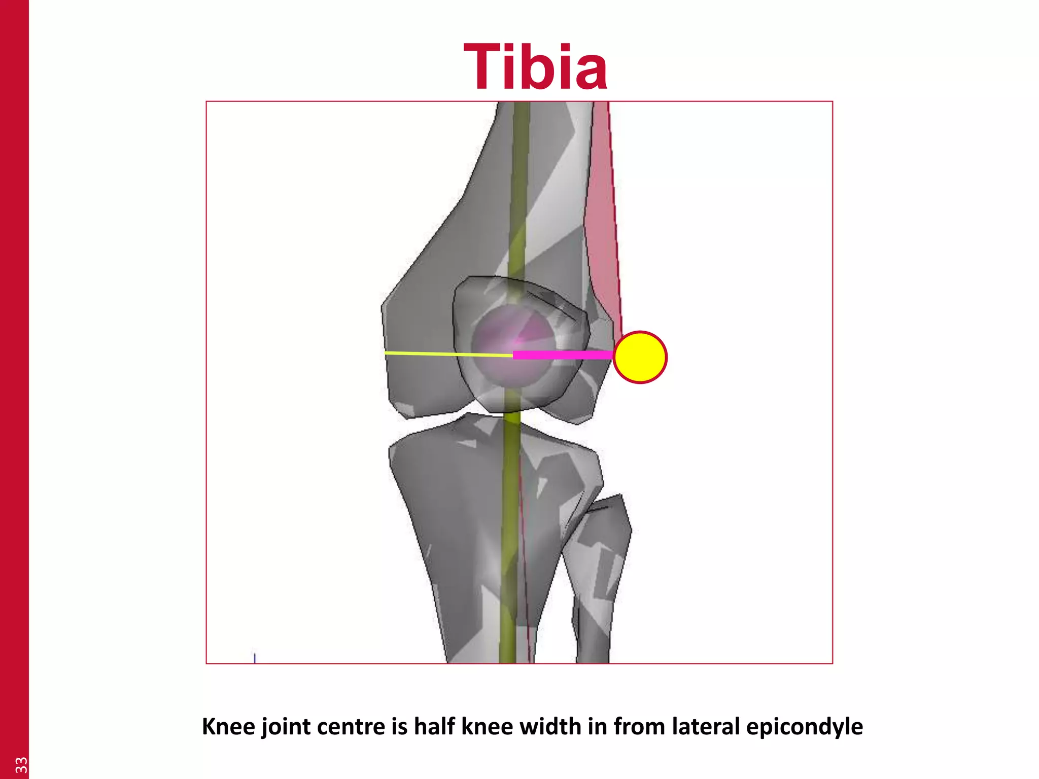 Tibia 
33 
Knee joint centre is half knee width in from lateral epicondyle 
 