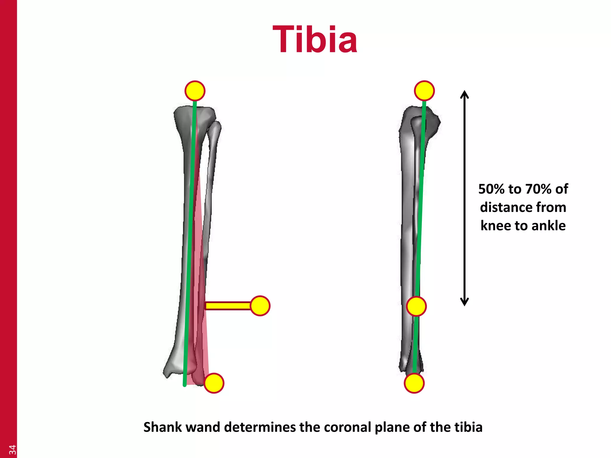 Tibia 
34 
50% to 70% of 
distance from 
knee to ankle 
Shank wand determines the coronal plane of the tibia 
 