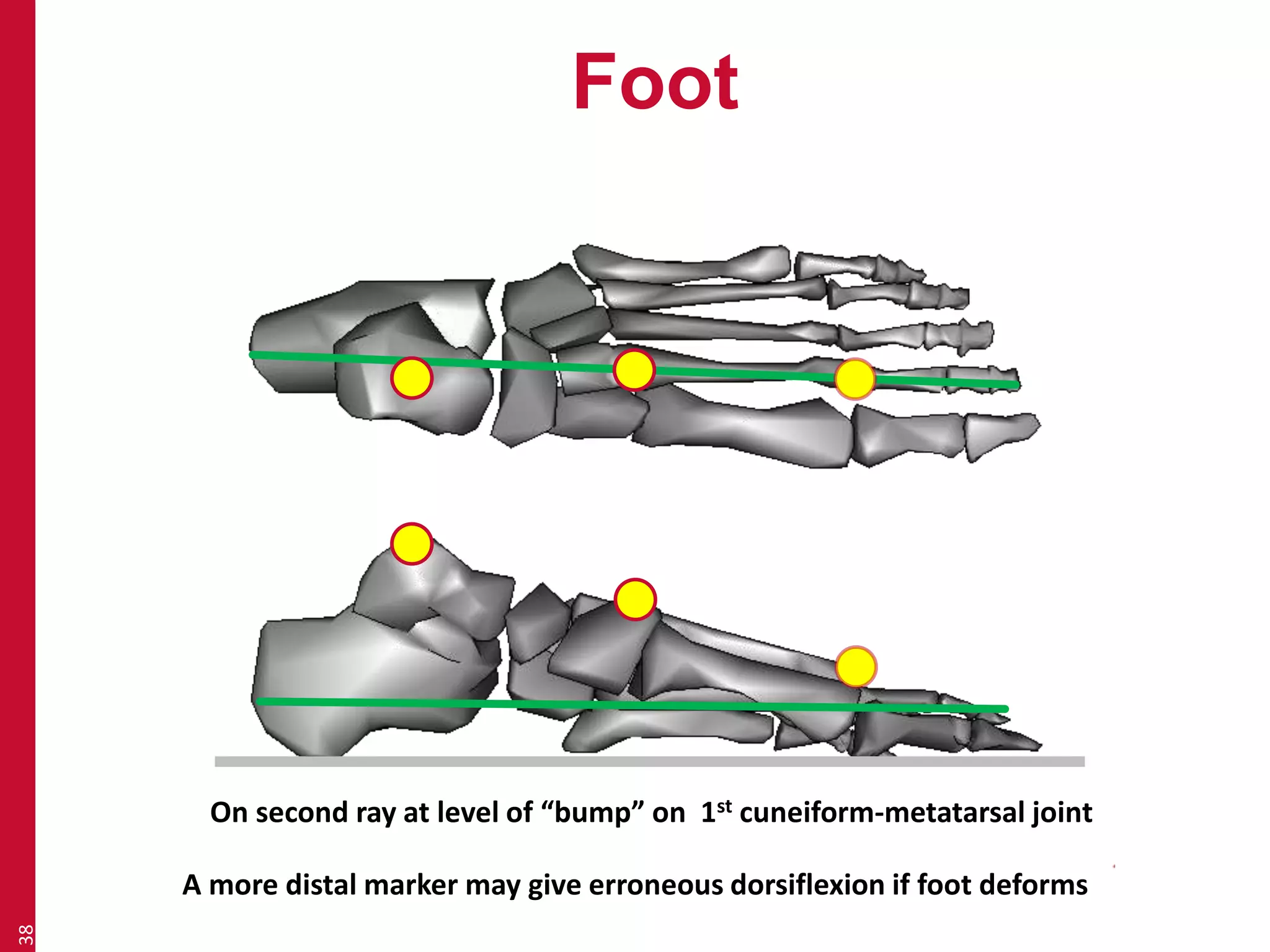 Foot 
38 
On second ray at level of “bump” on 1st cuneiform-metatarsal joint 
A more distal marker may give erroneous dorsiflexion if foot deforms 
 