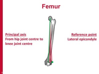 Femur 
10 
Principal axis 
From hip joint centre to 
knee joint centre 
Reference point 
Lateral epicondyle 
 