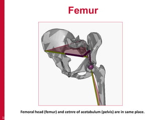 Femur 
22 
Femoral head (femur) and cetnre of acetabulum (pelvis) are in same place. 
 