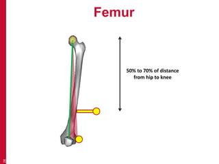 Femur 
28 
50% to 70% of distance 
from hip to knee 
 