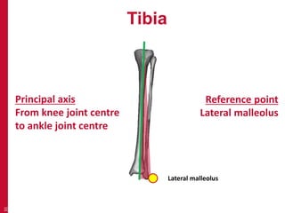 Tibia 
31 
Principal axis 
From knee joint centre 
to ankle joint centre 
Reference point 
Lateral malleolus 
Lateral malleolus 
 