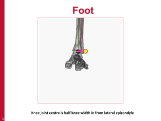 Foot 
37 
Knee joint centre is half knee width in from lateral epicondyle 
 