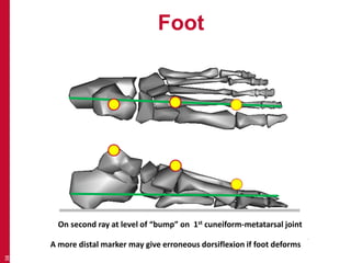 Foot 
38 
On second ray at level of “bump” on 1st cuneiform-metatarsal joint 
A more distal marker may give erroneous dorsiflexion if foot deforms 
 