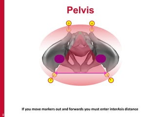 Pelvis 
46 
If you move markers out and forwards you must enter interAsis distance 
 