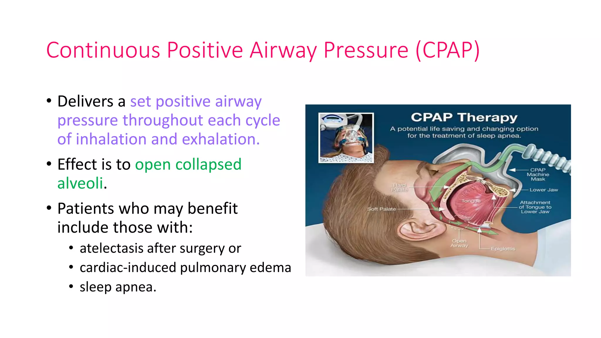 Continuous Positive Airway Pressure (CPAP)
• Delivers a set positive airway
pressure throughout each cycle
of inhalation and exhalation.
• Effect is to open collapsed
alveoli.
• Patients who may benefit
include those with:
• atelectasis after surgery or
• cardiac-induced pulmonary edema
• sleep apnea.
 