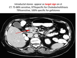 what is jaundice ? causes ? types ? surgical treatment | PPTX