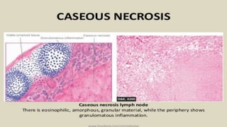 Noncaseating Necrosis Necrosis and it's types | PPTX