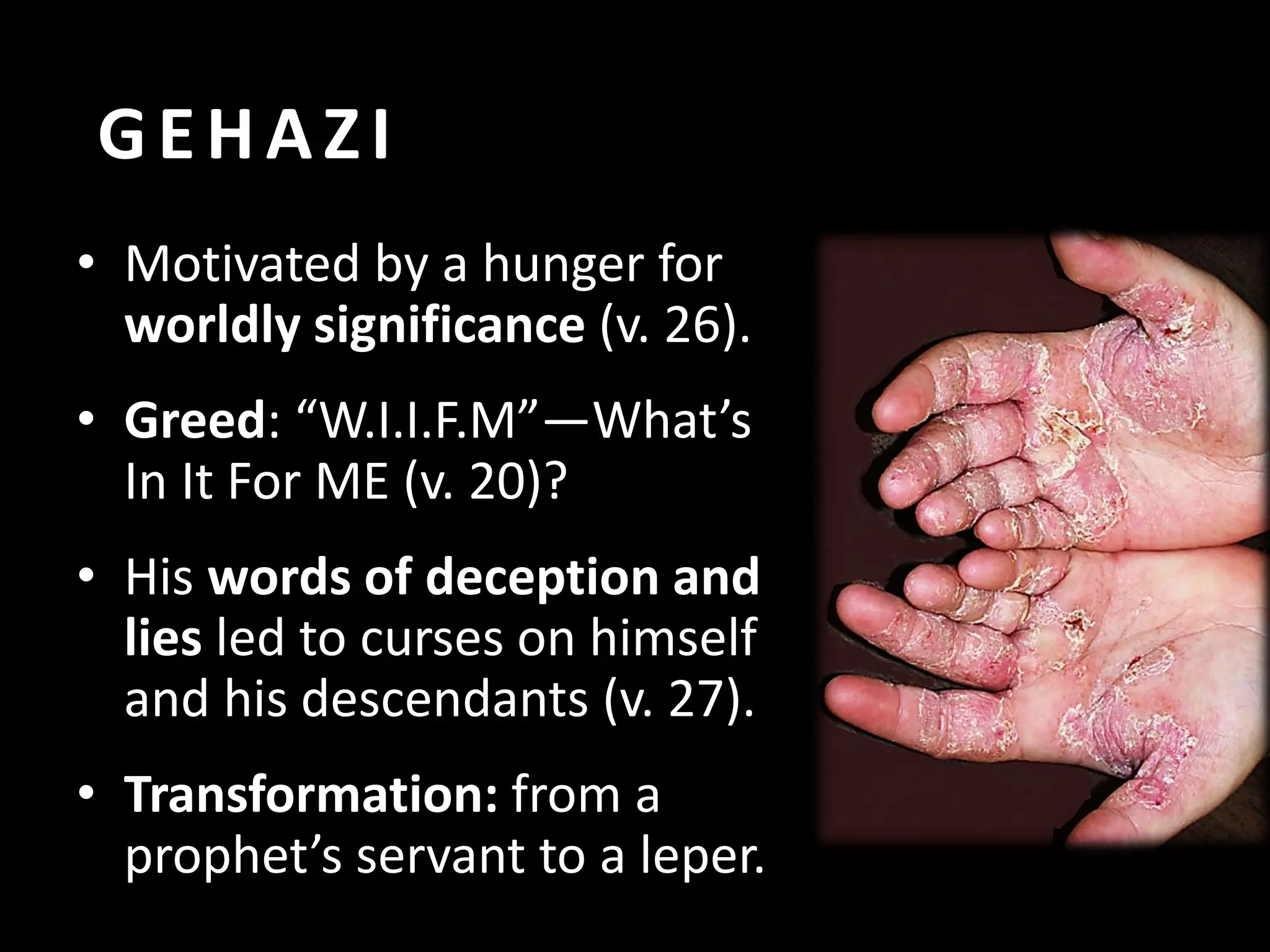 GEHAZI
• Motivated by a hunger for
worldly significance (v. 26).
• Greed: “W.I.I.F.M”—What’s
In It For ME (v. 20)?
• His words of deception and
lies led to curses on himself
and his descendants (v. 27).
• Transformation: from a
prophet’s servant to a leper.

 