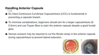 posterior capsular rent and nucleus drop | PPTX