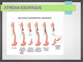 2_KULIAH_Kelainan_Kongenital_Saluran_Ce.ppt