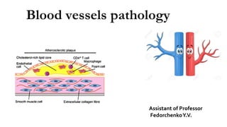 Blood vessels pathology
Assistant of Professor
FedorchenkoY.V.
 