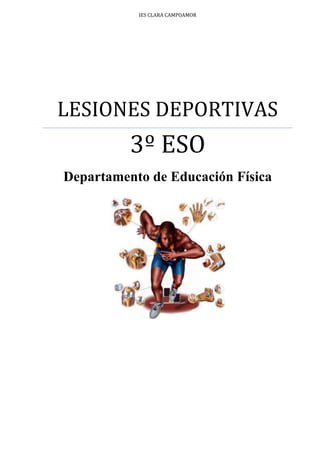 ies clara campoamorLESIONES DEPORTIVAS3º ESODepartamento de Educación Física<br />Índice: TOC  quot;
1-3quot;
    1. INTRODUCCIÓN PAGEREF _Toc281937145  32. RECORDATORIO BÁSICO DEL APARATO LOCOMOTOR. PAGEREF _Toc281937146  32.1. SITEMA MUSCULAR PAGEREF _Toc281937147  32.2. SISTEMA OSEO-ARTICULAR PAGEREF _Toc281937148  52.3. LAS ARTICULACIONES PAGEREF _Toc281937149  63. LESIONES EN EL APARATO LOCOMOTOR PAGEREF _Toc281937150  73.1. LESIONES OSEAS PAGEREF _Toc281937151  73.1.1. FRACTURAS PAGEREF _Toc281937152  73.1.2. LUXACIONES PAGEREF _Toc281937153  83.1.3. PERIOSTITIS PAGEREF _Toc281937154  83.2. LESIONES MUSCULARES PAGEREF _Toc281937155  93.2.1. ELONGACIÓN, DESGARRO Y RUPTURA MUSCULAR PAGEREF _Toc281937156  93.2.2. CONTRACTURA MUSCULAR PAGEREF _Toc281937157  93.2.3. CALAMBRES PAGEREF _Toc281937158  93.3. LESIONES LIGAMENTOSAS PAGEREF _Toc281937159  103.3.1. ESGUINCE O DISTENSIÓN PAGEREF _Toc281937160  103.4. LESIONES TENDINOSAS PAGEREF _Toc281937161  113.4.1. ENFERMEDAD DE LAS INSERCIONES PAGEREF _Toc281937162  113.4.2. ROTURA TENDINOSA PAGEREF _Toc281937163  11<br />1. INTRODUCCIÓN<br />329565553720Haciendo DEPORTE surgen algunos problemas en forma de lesiones; tú mismo lo habrás sufrido alguna vez, o algún compañero; que inmediatamente son detectados por nuestro organismo, y a través de múltiples mecanismos nos pone en alerta. Son accidentes que se presentan de repente cuando estamos realizando un ejercicio, o que son consecuencia de una mala preparación, cansancio, infracción de normas de seguridad, etc.<br />Los deportistas están sometidos a este tipo de contratiempos con bastante frecuencia, como cualquier persona que practique algún deporte. Por muchas causas, el cuerpo a veces falla, pero con fortuna suele tener solución si se tiene un poco de paciencia y ganas de recuperarse.<br />2. RECORDATORIO BÁSICO DEL APARATO LOCOMOTOR.<br />2.1. SITEMA MUSCULAR<br />Los músculos son los motores del movimiento. Un músculo, es un haz de fibras, cuya propiedad más destacada es la contractilidad. Gracias a esta facultad, el paquete de fibras musculares se contrae cuando reciben una  orden adecuada. Al contraerse, se acorta y se tira del hueso o de la estructura sujeta. Acabado el trabajo, recupera su posición de reposo. <br />Los músculos estriados son rojos, tienen una contracción rápida y voluntaria y se insertan en los huesos a través de un tendón, por ejemplo, los de la masticación, el trapecio, que sostiene erguida la cabeza, o los gemelos en las piernas que permiten ponerse de puntillas.<br />Los músculos lisos son blanquecinos, tapizan tubos y conductos y tienen contracción lenta e involuntaria. Se encuentran por ejemplo, recubriendo el conducto digestivo o los vasos sanguíneos (arterias y venas). El músculo cardiaco es un caso especial, pues se trata de un músculo estriado, de contracción involuntaria. <br />El cuerpo humano se cubre de unos 650 músculos de acción voluntaria. Tal riqueza muscular permite disponer de miles de movimientos. Hay músculos planos como el recto del abdomen, en forma de huso como el bíceps o muy cortos como los interóseos del metacarpo. Algunos músculos son muy grandes, como el dorsal en la espalda, mientras otros muy potentes como el cuádriceps en el muslo. Además los músculos sirven como protección a los órganos internos así como de dar forma al organismo y expresividad al rostro. <br />Los músculos son conjuntos de células alargadas llamadas fibras. Están colocadas en forma de haces que a su vez están metidos en unas vainas conjuntivas que se prolongan formando los tendones, con lo que se unen a los huesos. Su forma es variable. La más típica es la forma de huso (grueso en el centro y fino en los extremos). <br />Los músculos más importantes en nuestro organismo están representados en el siguiente gráfico:<br />2.2. SISTEMA OSEO-ARTICULAR<br />El cuerpo humano es una complicada estructura de más de doscientos huesos, un centenar de articulaciones y más de 650 músculos actuando coordinadamente. Gracias a la colaboración entre huesos y músculos, el cuerpo humano mantiene su postura, puede desplazarse y realizar múltiples acciones. <br />El conjunto de huesos y cartílagos: forma el ESQUELETO.<br />-184785145415<br />El hueso es un tejido sorprendente, ya que combina células vivas (osteocitos) y materiales inertes (sales de calcio). De esta unión, surge la fuerza, pero también la ligereza y la resistencia de los huesos. Los huesos se están renovando constantemente. <br />Las funciones del esqueleto son múltiples: <br />Sostiene al organismo y protege a los órganos delicados, a la vez que sirve de punto de inserción a los tendones de los músculos.<br /> El interior de los huesos largos aloja la medula ósea, un tejido noble que fabrica glóbulos rojos y blancos. <br />La cabeza está constituida por el cráneo y la cara. Es una sucesión compleja de huesos que protegen el encéfalo y a otros órganos del sistema nervioso central. También da protección a los órganos de los sentidos, a excepción del tacto que se encuentra repartido por toda la superficie de la piel. <br />72390273685La COLUMNA VERTEBRAL es un pilar recio, pero un poco flexible, formada por una treintena de vértebras que cierra por detrás la caja torácica. En la porción dorsal de la columna, se articula con las costillas. <br />66675829310El TORAX es una caja semirrígida que colabora activamente durante la respiración: <br />Hay varios tipos de huesos: <br />+ Largos, como los del brazo o la pierna.<br />+ Cortos, como los de la muñeca o las vértebras.<br />+ Planos, como los de la cabeza.<br />Dentro de los huesos podemos destacar:<br />91440113665<br />2.3. LAS ARTICULACIONES <br />Las articulaciones son estructuras que unen los distintos segmentos óseos del cuerpo, y que se pueden clasificar en:<br />2457450269875Sinartrosis, son articulaciones sin posibilidad de movimiento de los segmentos óseos que unen (Ej. Los huesos del cráneo).<br />Anfiartrosis, son articulaciones con escasa movilidad o semimóviles. Ej. Las uniones entre distintas vértebras permiten un ligero grado de -337185716915movilidad.<br />3114675336550<br />Diartrosis, son articulaciones con amplia movilidad. Estas articulaciones constan de unos elementos más o menos constantes:<br />Deberíamos añadir a este diagrama los ligamentos y los meniscos que poseen algunas diartrosis:<br />3. LESIONES EN EL APARATO LOCOMOTOR<br />3.1. LESIONES OSEAS<br />3.1.1. FRACTURAS<br />Ocurre cuando un hueso se rompe total o parcialmente. Puede causarla una caída, un golpe fuerte y, a veces un movimiento de torsión (contracción violenta de un músculo). La mayoría de las veces se requiere una fuerza considerable para que un hueso se rompa, pero en niños y ancianos los huesos son más frágiles, razón por la cual son más frecuentes las fracturas en estas personas. <br />Estas lesiones solamente pueden poner la vida en peligro si van acompañadas de hemorragia arterial o si comprometen el sistema nervioso, produciendo parálisis como en las fracturas de la columna vertebral. <br />Las fracturas pueden ser: <br />11049032385* FRACTURA CERRADA <br />Es aquella en la cual el hueso se rompe y la piel permanece intacta. <br />* FRACTURA ABIERTA <br />Implica la presencia de una herida abierta y salida del hueso fracturado al exterior<br />Las fracturas además pueden ser: <br />MULTIPLE: <br />Cuando el hueso se rompe en varias fracciones, denominadas esquirlas. <br />INCOMPLETA: Fisura o un leño verde cuando la ruptura del hueso no es total. <br />-260985324485Los síntomas de estas lesiones son:<br />+ Dolor, tumefacción, impotencia funcional, hematoma y movilidad anormal.<br />El tratamiento es:<br />+ Inmovilización con escayola.<br />+ Rehabilitación progresiva.<br />3.1.2. LUXACIONES<br />-60960466725Las LUXACIONES generalmente son más obvias que las fracturas. Una luxación se observa cuando un hueso se ha desplazado de su articulación. Este desplazamiento es causado, generalmente, por una fuerza violenta que desgarra los ligamentos que mantiene los huesos en su sitio.<br />Cuando un hueso se sale de su sitio la articulación deja de funcionar. El hueso desplazado a menudo forma una hinchazón, una prominencia, o una depresión, que normalmente no esta presente. <br />Las articulaciones más afectadas son: hombro, codo, cadera, rodilla, tobillo, dedo pulgar, dedo grueso del pie y mandíbula. <br />En caso de accidente automovilístico es frecuente la luxación de las vértebras cervicales. <br />3.1.3. PERIOSTITIS<br />-60960172720Es un cuadro caracterizado por dolor en superficies óseas sobresalientes, producidas en general por micro tracciones o por vibración. Los puntos más frecuentes son: cara antero externa de la tibia, cresta iliaca y los maléolos.<br />Los síntomas son:<br />Dolor durante el esfuerzo que remite durante el reposo.<br />Dolor a la palpación selectiva.<br />El tratamiento:<br />Hielo inmediatamente después del ejercicio.<br />Calor progresivo pasadas unas horas.<br />Antiinflamatorios locales.<br />A veces su evolución es lenta o puede no llegar a desaparecer.<br />3.2. LESIONES MUSCULARES<br />3.2.1. ELONGACIÓN, DESGARRO Y RUPTURA MUSCULAR<br />-346710209550La elongación, desgarro y rotura muscular ocurre cuando los músculos  se estiran  en movimientos bruscos cuando el músculo está contraído. Las distensiones a menudo son causadas al levantar algo pesado o al forzar demasiado un músculo. Generalmente afectan a los músculos del cuello, la espalda, los muslos o la parte posterior de la pierna (la pantorrilla). Algunas distensiones pueden volver a ocurrir, sobre todo las que ocurren en el cuello o la espalda. <br />Los síntomas  son:<br />Dolor e inflamación.<br />Hematoma central o periférico.<br />Corte a la palpación.<br />Cojera si es en el miembro inferior.<br />El tratamiento de estas lesiones es:<br />Hielo 30 minutos y descanso de 30 minutos durante las 48-72 horas después de la lesión.<br />Reposo funcional.<br />Vendaje comprensivo.<br />Elevación del miembro.<br />Antiinflamatorios.<br />NUNCA DAR MASAJES.<br />3.2.2. CONTRACTURA MUSCULAR<br />left88265<br />Producida por movimientos en frío o por sobrecarga.<br />Los síntomas son:<br />Dolor a la movilización.<br />Sensación de cuerda a la palpación.<br />El tratamiento es:<br />Calor local.<br />Pomadas antiinflamatorias.<br />Relajantes musculares.<br />Calentamiento previo al ejercicio.<br />3.2.3. CALAMBRES<br />-213360171450<br />Eliminando los producidos por causas generales (Fiebre, enfermedades, reposo excesivo, estancia prolongada en la cama, etc. )  o por falta de riego sanguíneo, distinguimos lo siguientes:<br />Durante el esfuerzo: Producidos por movimientos defectuosos o por falta de riego sanguíneo.<br />Después del esfuerzo: es general, por fatiga.<br /> Nocturnos: Producidos por alteraciones en el retorno venoso.<br />El tratamiento:<br />Fisioterapia: baños calientes y masajes.<br />Relajantes musculares.<br />Vitaminas y minerales. Sobre todo ingerir Potasio y Magnesio.<br />3.3. LESIONES LIGAMENTOSAS.<br />3.3.1. ESGUINCE O DISTENSIÓN<br />left523875<br />Elongación de los ligamentos que sujetan una articulación, producido por un movimiento forzado. Es una patología de las más frecuentes a la hora de realizar cualquier actividad física.<br />Cuando una persona se tuerce una articulación, los ligamentos que están bajo la piel, se lastiman. La sangre y los fluidos se filtran a través de los vasos sanguíneos desgarrados y ocasionan inflamación y dolor en el área de la lesión. <br />Un esguince serio puede incluir una fractura o luxación de los huesos de la articulación. Las articulaciones que se lastiman con más facilidad son las que se encuentran en el tobillo, codo, la rodilla, la muñeca y los dedos. <br />Podemos destacar:lefttop<br />Esguince de rodilla: Producido por una torsión o movimiento asincrónico de la rodilla. El traumatismo a veces puede no ser claro. Mayor frecuencia a nivel del ligamento lateral interno por el aumento del valgo fisiológico.<br />166306565405Esguince de tobillo: Ocurre cuando el píe se hiperflexiona hacia adentro. Dolor vivo en la parte externa del tobilo, al palpar o doblar el píe hacia adentro. Edema o hematoma, que si son muy pronunciados pueden indicar rotura completa del ligamento.<br />Los síntomas de estas lesiones son:<br />Dolor en la zona lastimada.<br />Impotencia funcional que en el deportista es muy bien tolerada mientras está en ejercicio.<br />Hematoma e inflamación.<br />El tratamiento:<br />Hielo durante las primeros 72 horas.<br />Reposo absoluto durante las 48 horas y relativo a continuación con vendaje comprensivo.<br />Al cuarto día calor y pomada antiinflamatoria.<br />Importancia de la rehabilitación progresiva sin sobrecarga.<br />3.4. LESIONES TENDINOSAS<br />3.4.1. ENFERMEDAD DE LAS INSERCIONES<br />3425190603250Cuadro inflamatorio o degenerativo del punto de unión osteotendinoso. Las causas de este tipo de lesiones son:<br />Intrínsecas: la edad, mala alineación de los segmentos óseos, desequilibrio muscular, etc.<br />Extrínsecas: calidad del terreno, errores de entrenamiento, técnica defectuosa, equipos no apropiados, etc.<br />El síntoma de esta lesión es.<br />Dolor espontáneo irradiado a la masa muscular.<br />El tratamiento:<br />+ Hielo tras el ejercicio.<br />+ Reposo funcional.<br />+ Pomadas antiinflamatorias.<br />3.4.2. ROTURA TENDINOSA<br />2958465356870Producida en general, por un movimiento brusco o demasiado violento.<br />Los síntomas son:<br />Dolor agudo e inflamación local.<br />Impotencia funcional.<br />El tratamiento:<br />Inmovilización con escayola o intervención quirúrgica en los casos graves.<br />Reposo funcional.<br />Antiinflamatorios.<br />Recuperación progresiva.<br />