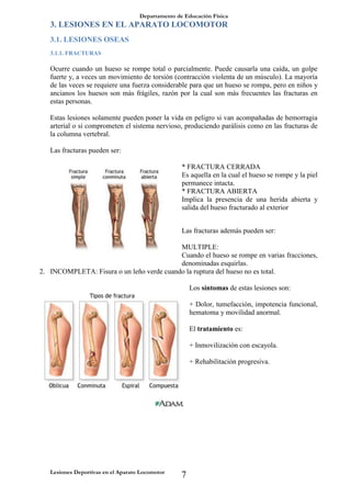 Departamento de Educación Física
Lesiones Deportivas en el Aparato Locomotor
7
3. LESIONES EN EL APARATO LOCOMOTOR
3.1. LESIONES OSEAS
3.1.1. FRACTURAS
Ocurre cuando un hueso se rompe total o parcialmente. Puede causarla una caída, un golpe
fuerte y, a veces un movimiento de torsión (contracción violenta de un músculo). La mayoría
de las veces se requiere una fuerza considerable para que un hueso se rompa, pero en niños y
ancianos los huesos son más frágiles, razón por la cual son más frecuentes las fracturas en
estas personas.
Estas lesiones solamente pueden poner la vida en peligro si van acompañadas de hemorragia
arterial o si comprometen el sistema nervioso, produciendo parálisis como en las fracturas de
la columna vertebral.
Las fracturas pueden ser:
* FRACTURA CERRADA
Es aquella en la cual el hueso se rompe y la piel
permanece intacta.
* FRACTURA ABIERTA
Implica la presencia de una herida abierta y
salida del hueso fracturado al exterior
Las fracturas además pueden ser:
1. MULTIPLE:
Cuando el hueso se rompe en varias fracciones,
denominadas esquirlas.
2. INCOMPLETA: Fisura o un leño verde cuando la ruptura del hueso no es total.
Los síntomas de estas lesiones son:
+ Dolor, tumefacción, impotencia funcional,
hematoma y movilidad anormal.
El tratamiento es:
+ Inmovilización con escayola.
+ Rehabilitación progresiva.
 