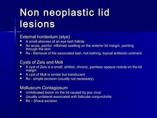 Non neoplastic lidNon neoplastic lid
lesionslesions
External hordeolum (stye)External hordeolum (stye)
 A small abscess of an eye lash follicleA small abscess of an eye lash follicle
 An acute, painful inflamed swelling on the anterior lid margin, pointingAn acute, painful inflamed swelling on the anterior lid margin, pointing
through the skinthrough the skin
 Rx - Removal of the associated lash, hot bathing, topical antibiotic ointmentRx - Removal of the associated lash, hot bathing, topical antibiotic ointment
Cysts of Zeis and MollCysts of Zeis and Moll
 A cyst of Zeis is a small, whitish, chronic, painless opaque nodule on the lidA cyst of Zeis is a small, whitish, chronic, painless opaque nodule on the lid
marginmargin
 A cyst of Moll is similar but translucentA cyst of Moll is similar but translucent
 Rx - simple excision (usually not necessary)Rx - simple excision (usually not necessary)
Molluscum ContagiosumMolluscum Contagiosum
 Umbilicated lesion on the lid caused by pox virusUmbilicated lesion on the lid caused by pox virus
 Usually unilateral associated with follicular conjunctivitisUsually unilateral associated with follicular conjunctivitis
 Rx – Shave excisionRx – Shave excision
 