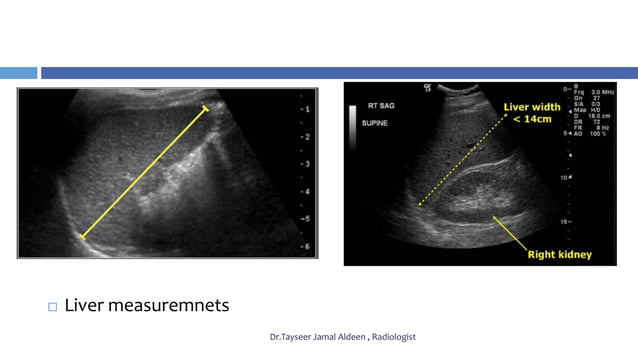 Liver Graph liver ultrasonography | PPTX | Endocrine and Metabolic Diseases ...