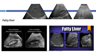 Liver Graph liver ultrasonography | PPTX