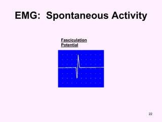 EMG: Spontaneous Activity
22
Fasciculation
Potential
 