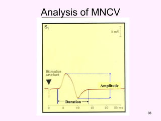 36
Duration
Amplitude
Analysis of MNCV
 