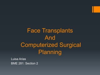 Face Transplants
And
Computerized Surgical
Planning
Luisa Arias
BME 281: Section 2
 