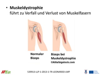 539913-LLP-1-2013-1-TR-LEONARDO-LMP
• Muskeldystrophie
führt zu Verfall und Verlust von Muskelfasern
Normaler
Bizeps
Bizeps bei
Muskeldystrophie
 