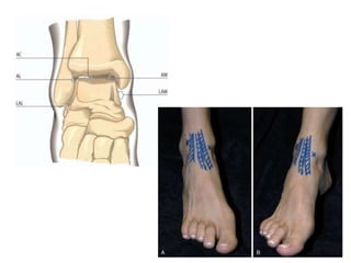 Arthroscopy of Ankle and Wrist