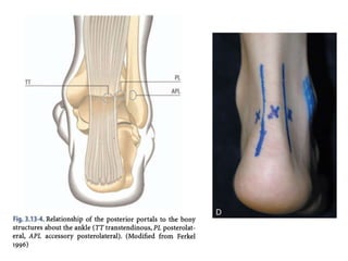 Arthroscopy of Ankle and Wrist