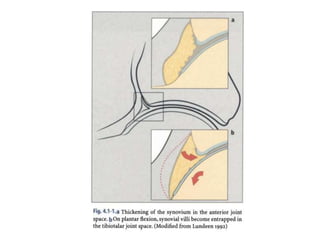 Arthroscopy of Ankle and Wrist