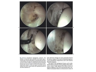 Arthroscopy of Ankle and Wrist