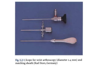 Arthroscopy of Ankle and Wrist